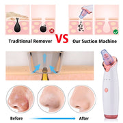 Blackhead Instrument Electric Suction Facial Washing virtual