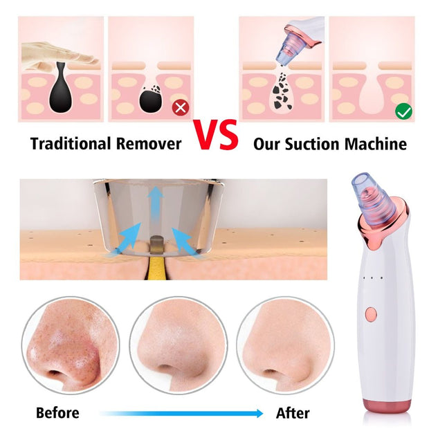 Blackhead Instrument Electric Suction Facial Washing virtual