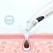 Electric Visual Blackhead Suction Instrument Household Cleansing Pore Cleaner For Skin Equipment Skin Care Tool virtual