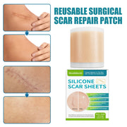 Self-adhesive Silicone Scar Paster Repair And Care Beauty Stickers virtual