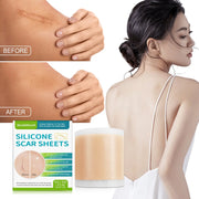 Self-adhesive Silicone Scar Paster Repair And Care Beauty Stickers virtual