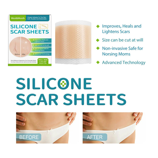 Self-adhesive Silicone Scar Paster Repair And Care Beauty Stickers virtual